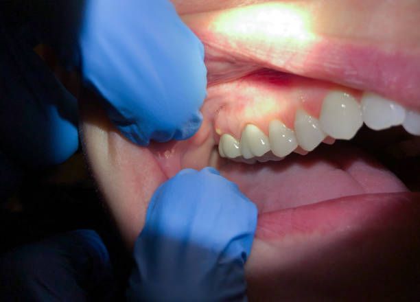 Best Cosmetic Emergency Dentistry in Torrance, CA